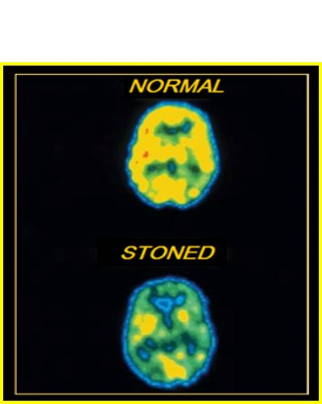Figure 1: Past Month Illicit Drug Use Among Persons Aged 12 or Older: 2011. Illicit drugs: 22.5, Marijuana: 18.1, Psychotherapeutics: 6.1, Cocaine: 1.4, Hallucinogens: 1.0, Inhalants: 0.6, Heroin: 0.3.  Numbers in Millions.