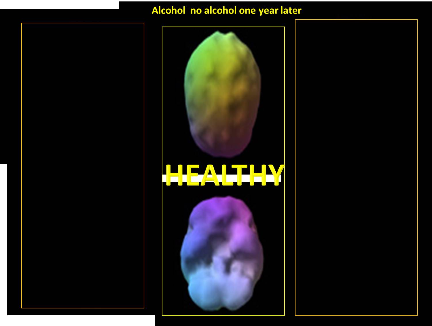 alcohol no alcohol