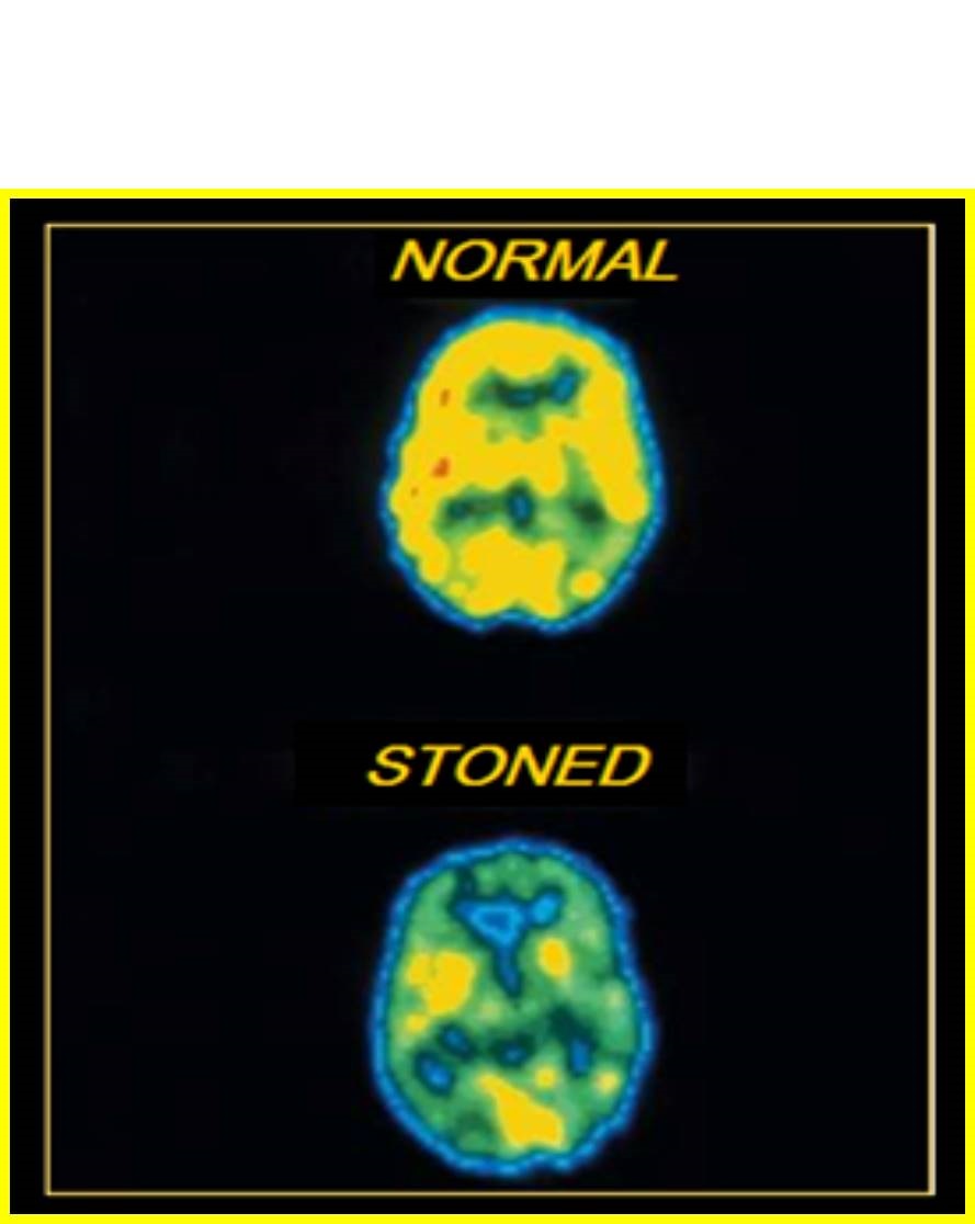marijuana brain